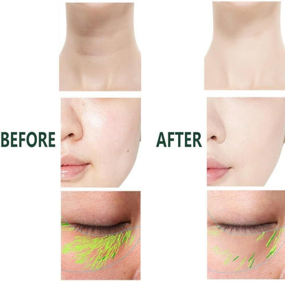 Anti Wrinkles Facial Massager For Skin Care